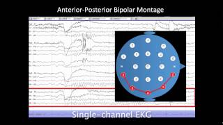 Introduction to EEG [upl. by Cissy]