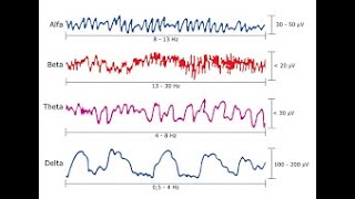 Electroencefalograma [upl. by Veator]