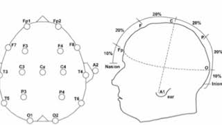 Electroencephalograph EEG [upl. by Strauss]