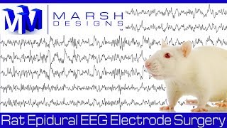 Fundamentals of EEG Signal [upl. by Olzsal]